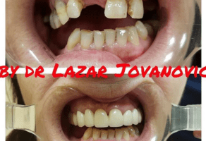 Dental Studio DrO – Stomatološka ordinacija – Beograd