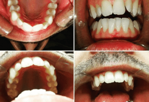 Dental Studio DrO – Stomatološka ordinacija – Beograd