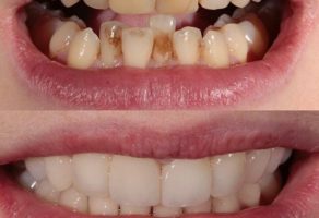 Stomatološka ordinacija Branko Dental Tehno Niš