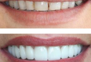 Stomatološka ordinacija Branko Dental Tehno Niš