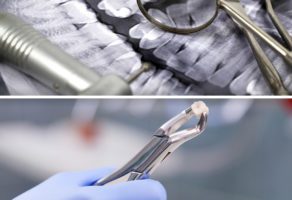 Stomatoloska ordinacija Kuprešanin Subotica