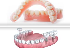 Stomatoloska ordinacija Kuprešanin Subotica