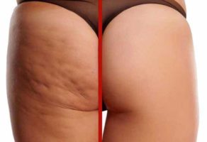 TINA LUX – Salon lepote – Novi Beograd