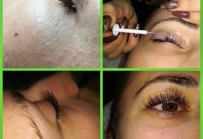 Kozmetički Salon BELLEZZA – Čačak