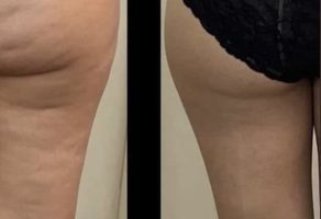 TINA LUX – Salon lepote – Novi Beograd