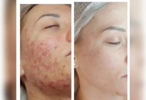 Kozmetički salon za žene i muškarce Jellena Beauty Kikinda