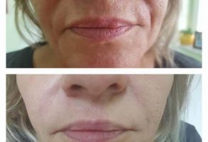 Beauty Studio Fantast – Vrbas